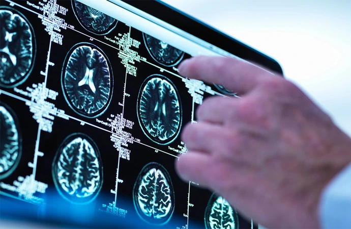 New MRI scan discovery could save 'vast numbers of lives'