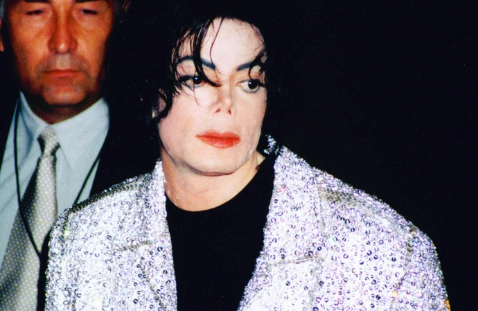 Michael lived with vitiligo