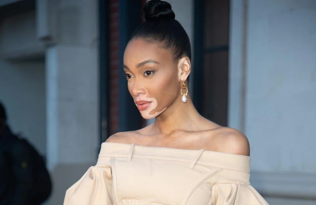 Winnie Harlow has announced her engagement