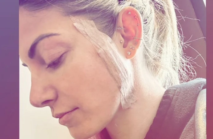 Alexa Bliss had cancerous cells removed (c) Instagram