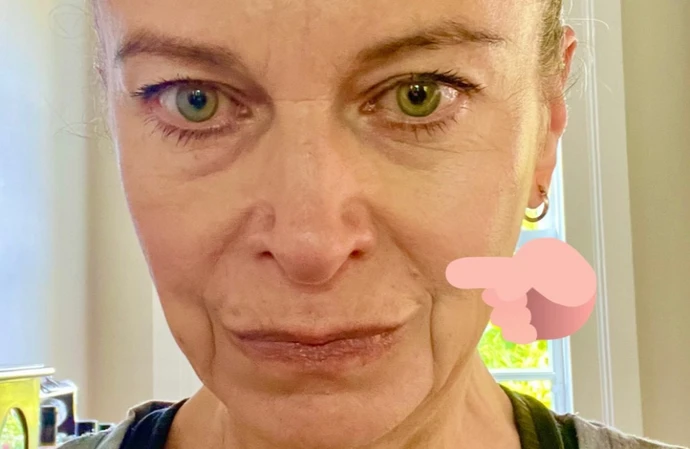 Ricky Gervais’ long-term partner Jane Fallon has opened up about a ‘worrying’ skin cancer scare