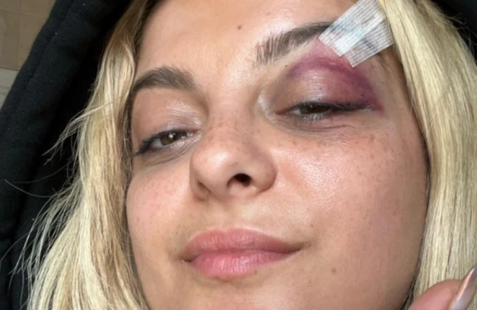Bebe Rexha has reveals her injuries