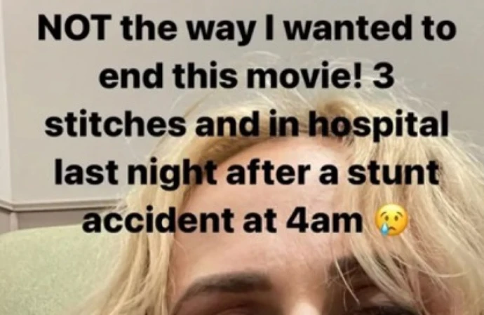 Rebel Wilson required stitches after suffering an injury
