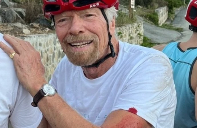 Richard Branson was left with cuts and bruises after a cycling accident