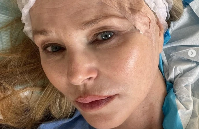 Christie Brinkley says her surgery scar has healed up well
