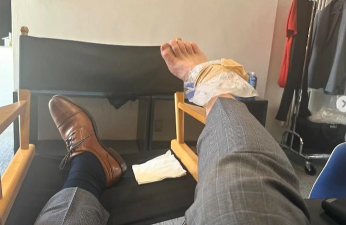 Chris Pratt has hurt his ankle (c) Instagram