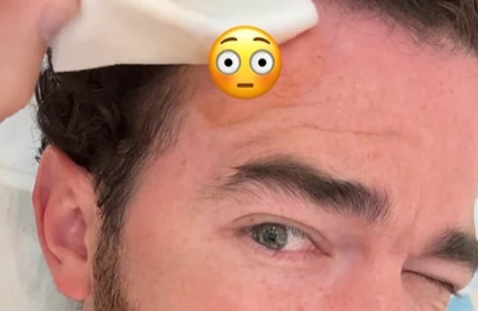 Kevin Jonas had skin cancer treatment (c) Instagram