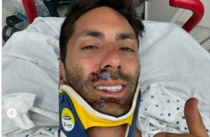 Nev Schulman broke his neck (c) Instagram