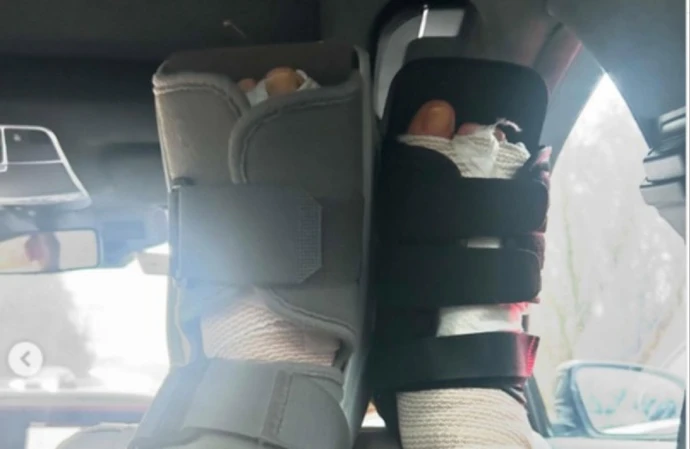 Lara Spencer has had two foot operations (c) Instagram