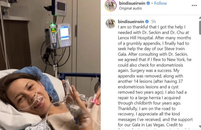Bindi Irwin is 'on the road to recovery' after having appendix and 14 endometriosis lesions removed