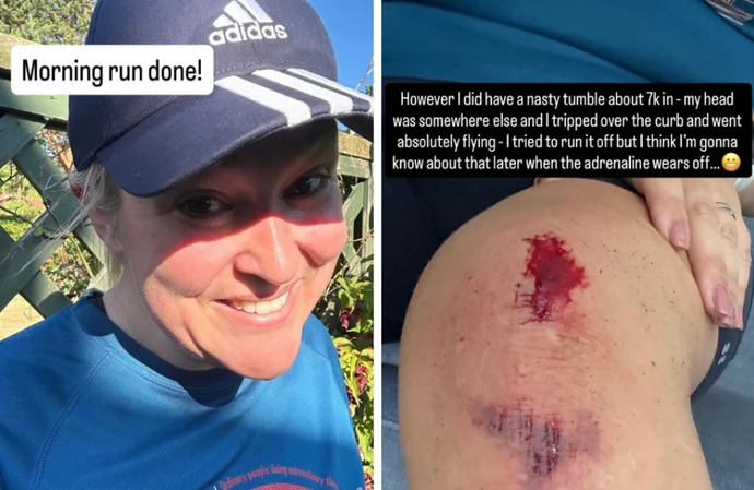 Sara Davies and her knee injury / Credit: Instagram