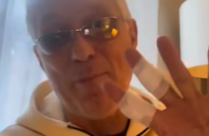 Martin Kemp shows bandaged fingers / © Instagram