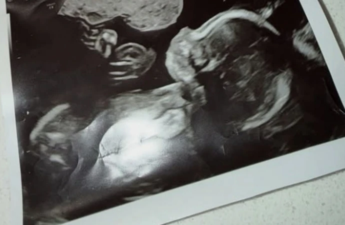 Thomas Skinner's wife Sinead is pregnant with the couple's fourth child © @iamtomskinner / Instagram