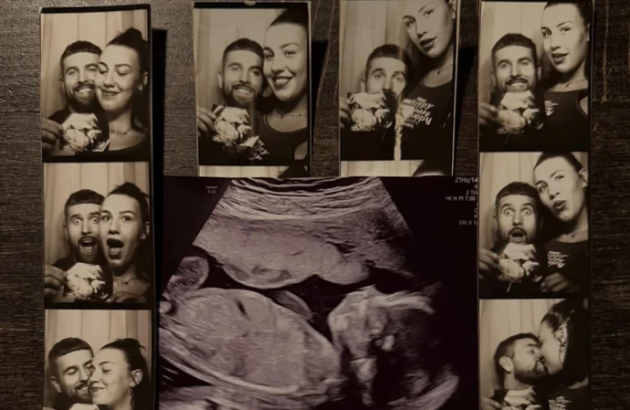 Zach Noble and Ava Hirons announce their pregnancy with baby scan photo / © Instagram