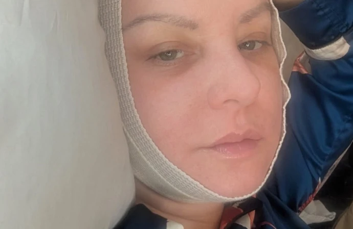 Wendi McLendon-Covey was absent from the Bridesmaids reunion at the 98th Academy Awards as she was recovering from plastic surgery