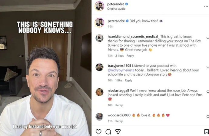 Peter Andre opens up about nose job