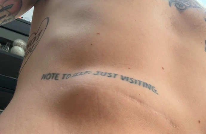 Professor Green's hernia / © Instagram