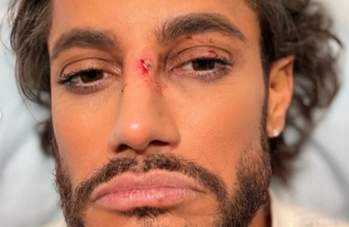 Frankie Grande got hurt on Broadway