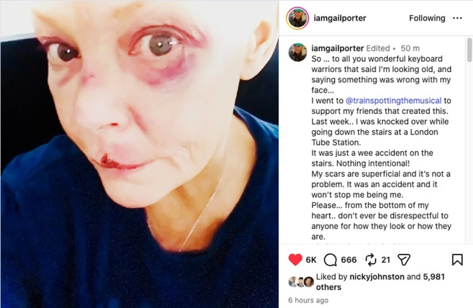 TV presenter Gail Porter / © Instagram