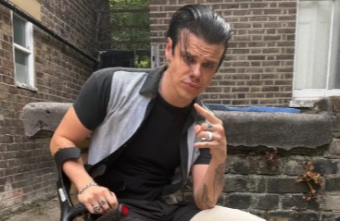 Yungblud is in a cast after breaking his leg in a motorcycle accident