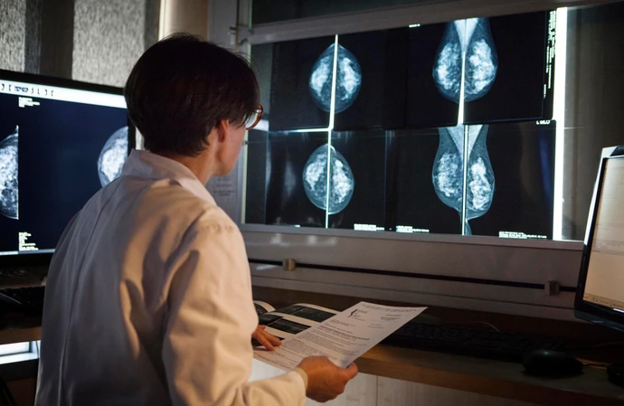 AI can detect heart disease in women through analysis of mammograms