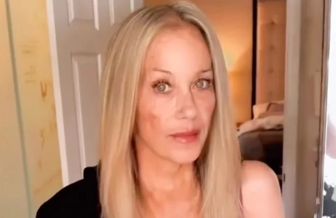 Christina Applegate shares first video since hospitalisation