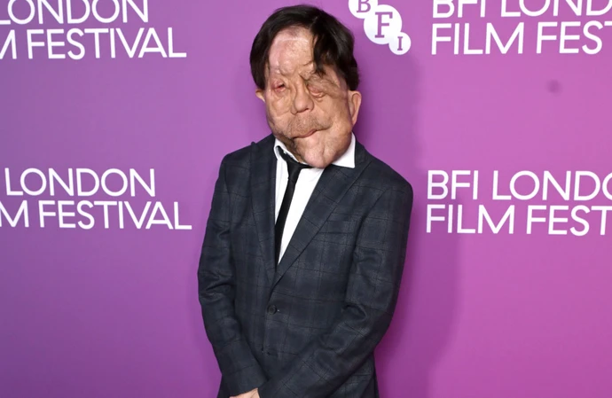 Adam Pearson feels progress is being made in terms of disability representation in the world of film